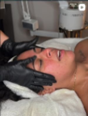 Sculpting facial massage on cheek
